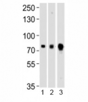 Western blot testing of Melk antibody at 1:1000 dilution and mouse 1) ovary, 2) spleen and 3) testis lysate; Predicted molecular weight ~ 73 kDa.