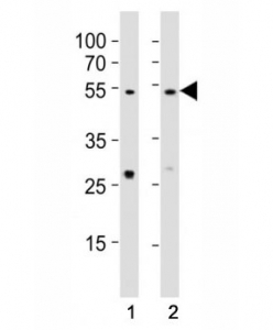 Western blot testing of EED antibody at 1:1000 dilution. Lane 1: A431 lysate; 2: NIH3T3 lysate; Predicted molecular weight: 50 kDa (isoform 1), 53 kDa (isoform 2), 46 kDa (isoform 3).
