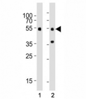 Western blot testing of Smad3 antibody at 1:1000 dilution. Lane 1: mouse brain tissue lysate; 2: rat brain tissue lysate; Observed molecular weight: 48~55 kDa.