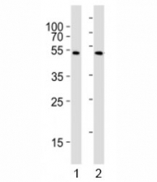 Western blot testing of NFKBIE antibody at 1:1000 dilution; Lane 1: A375 lysate, 2: Raji lysate