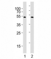 Western blot testing of NFKBIE antibody at 1:1000 dilution; Lane 1: A375 lysate, 2: Raji lysate