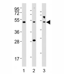 Western blot testing of NFKBIE antibody at 1:2000 dilution; Lane 1: HeLa lysate, 2: Jurkat lysate, 3: PC3 lysate~