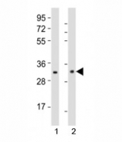 Western blot testing of Nkx2.5 antibody at 1:1000 dilution and mouse tissue; Lane 1: spleen lysate; 2: stomach lysate; Predicted molecular weight ~35kDa, routinely observed at 35~45kDa.