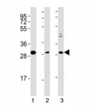 Western blot testing of Nkx2.5 antibody at 1:2000 dilution and mouse tissue; Lane 1: stomach lysate; 2: spleen lysate; 3: heart lysate; Predicted molecular weight ~35kDa, routinely observed at 35~45kDa.