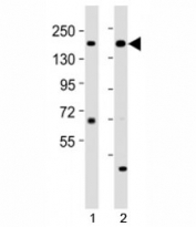 Western blot testing of Kdm6a antibody at 1:2000 dilution. Lane 1: mouse cerebellum lysate; 2: mouse spleen lysate; Predicted molecular weight ~ 154 kDa.