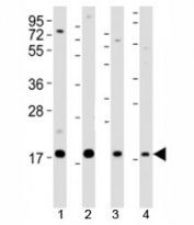 Western blot testing of Shh antibody at 1:2000 dilution. Lane 1: F9 lysate; 2: mouse stomach lysate; 3: NIH3T3 lysate; 4: rat liver lysate; Predicted molecular weight: 45/27/19 kDa (1)