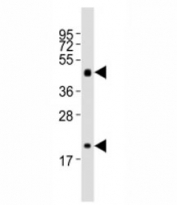 Western blot testing of Shh antibody at 1:2000 dilution + mouse stomach lysate; Predicted molecular weight: 45/27/19 kDa (1)