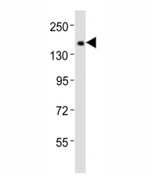 Western blot testing of Tet1 antibody at 1:2000 dilution + F9 lysate; Predicted band size : 219 kDa.