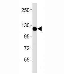 Western blot testing of CSF1R antibodyat 1:4000 dilution + U-87MG lysate; Predicted molecular weight: 106-116 kDa.~