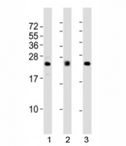 Western blot testing of FGF2 antibody at 1:2000 dilution; Lane 1: human A549 lysate, 2: mouse heart lysate; 3: rat lung lysate. Predicted molecular weight: 17-31 kDa (multiple isoforms).