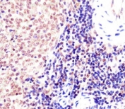 IHC testing of FFPE mouse spleen with Suz12 antibody at 1:25. HIER: steam sections in pH6 citrate buffer.