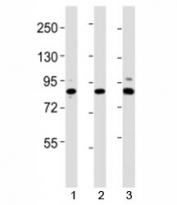 Western blot testing of Suz12 antibody at 1:2000 dilution. Lane 1: mouse spleen lysate; 2: mouse cerebellum lysate; 3: human HeLa lysate; Observed molecular weight 83~95 kDa.