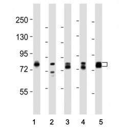 Western blot testing of DNM1L antibody at 1:8000 dilution and lysate from: 1: rat PC12; 2: human skeletal muscle; 3: HeLa; 4: mouse NIH3T3; 5: LNCaP; Predicted molecular weight is 82 kDa.