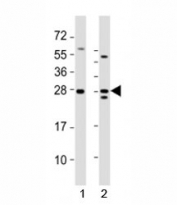 Western blot testing of Lin28a antibody at 1:2000 dilution. Lane 1: mouse F9 lysate; 2: human NCCIT lysate; Predicted molecular weight ~ 23 kDa.