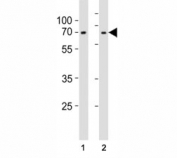 Western blot testing of Lamin A/C antibody at 1:1000 dilution. Lane 1: SH-SY5Y lysate; 2: PC3 lysate; Predicted band size : 70 kDa.