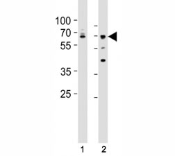 Western blot testing of Lamin A/C antibody at 1:500 dilution. Lane 1: A431 lysate; 2: HepG2 lysate; Predicted band size : 70 kDa.~