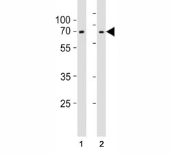 Western blot testing of Lamin A/C antibody at 1:1000 dilution. Lane 1: SH-SY5Y lysate; 2: PC3 lysate; Pr