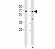 Western blot testing of Lamin A/C antibody at 1:500 dilution. Lane 1: A431 lysate; 2: HepG2 lysate; Predicted band size : 70 kDa.