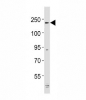 Western blot testing of Alk antibody at 1:2000 dilution + mouse cerebellum lysate; Predicted molecular weight: 190-220 kDa.