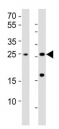 Western blot testing of RHOXF1 antibody at 1:1000; Lane 1: HL-60 whole lysate; Lane 2: human testis lysate. Predicted band size : 21 kDa