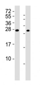 Western blot testing of RHOXF1 antibody at 1:2000; Lane 1: A2058 cell lysate, Lane 2: human ovary lysate. Predicted band size : 21 kDa~