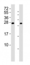 Western blot testing of RHOXF1 antibody at 1:2000; Lane 1: A2058 cell lysate, Lane 2: human ovary lysate. Predicted band size : 21 kDa
