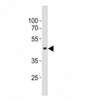 Western blot testing of EED antibody at 1:1000 dilution + mouse brain lysate; Predicted molecular weight: 50 kDa (isoform 1), 53 kDa (isoform 2), 46 kDa (isoform 3).