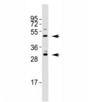 Western blot testing of Shh antibody at 1:1000 dilution + mouse stomach lysate; Predicted molecular weight: 45/27/19 kDa (1)