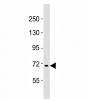 Western blot testing of FBXW7 antibody at 1:2000 dilution + Raji lysate; Predicted molecular weight: 80 kDa (alpha), 70 kDa (beta).