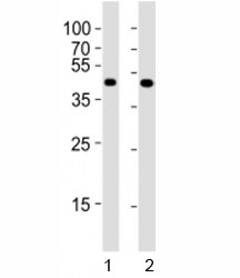 Western blot testing of Pou5f1 antibody at 1:4000 dilution. Lane 1: F9 lysate; 2: NCCIT lysate; Predicted molecular weight : 38 kDa.