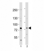 Western blot testing of Melk antibody at 1:1000 dilution. Lane 1: mouse spleen lysate; 2: mouse thymus lysate; Predicted molecular weight ~ 73 kDa.