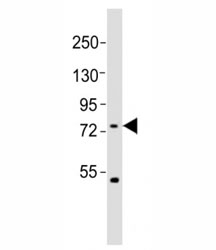 Western blot testing of FBXW7 antibody at 1:2000 dilution + HeLa lysate; Predicted molecular weight: 80 kDa (alpha), 70 kDa (beta).