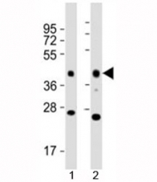 Western blot testing of EpCAM antibody at 1:2000 and mouse samples 1) lung and 2) kidney lysate; Expected molecular weight: ~35 kDa (unmodified), 40-43 kDa (glycosylated).