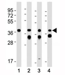 Western blot testing of EpCAM antibody at 1:2000 dilution. Lane 1: mouse kidney; 2: mouse colon; 3: human MCF-7; 4: rat colon lysate; Predicted molecular weight: 35 kDa.~