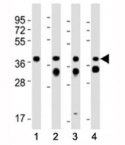 Western blot testing of EpCAM antibody at 1:2000 dilution. Lane 1: mouse kidney; 2: mouse colon; 3: human MCF-7; 4: rat colon lysate; Expected molecular weight: ~35 kDa (unmodified), 40-43 kDa (glycosylated).