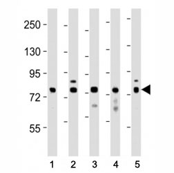 Western blot testing of DRP1 antibody at 1:1000 dilution and lysates: Lane 1: human heart; 2: LNCaP; 3: mouse NIH3T3; 4: rat PC12; 5: HeLa; Predicted molecular weight is 82 kDa.