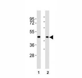 Western blot testing of CCR1 antibody at 1:2000 dilution. Lane 1: A375 lysate; 2: human skeletal muscle lysate; Predicted band size : 40-45 kDa.~