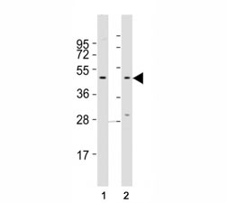Western blot testing of CCR1 antibody at 1:2000 dilution. Lane 1: A375 lysate; 2: Jurkat