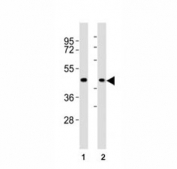 Western blot testing of CCR1 antibody at 1:2000 dilution. Lane 1: A375 lysate; 2: human skeletal muscle lysate; Predicted molecular weight: 40-45 kDa.