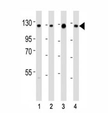 Western blot testing of anti-SIRT1 antibody at 1:2000 dilution. Lane 1: K562; 2: HeLa; 3: A549; 4: human testis lysate; Visualized from 80~120 kDa depending on post-translational modifications