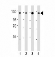 Western blot testing of anti-SIRT1 antibody at 1:2000 dilution. Lane 1: K562; 2: HeLa; 3: A549; 4: human testis lysate; Molecular weight: visualized from 80~120 kDa depending on post-translational modifications