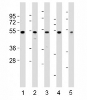 Western blot testing of NFKBIE antibody at 1:2000 dilution. Lane 1: PC3 lysate; 2: A375 lysate; 3: HeLa lysate; 4: LNCaP lysate; 5: THP-1 lysate; Predicted band size : 53 kDa.