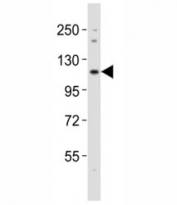 Western blot testing of Notch1 antibody at 1:2000 dilution + mouse lung lysate; Predicted molecular weight: ~ 270 kDa (full length), ~ 120 kDa (transmembrane fragment).