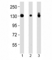 Western blot testing of Integrin alpha 3 antibody at 1:4000 dilution and 1) A431 lysate, 2) HeLa lysate, and 3) PC3 lysate at 1:2000.  Expected molecular weight: 119-150 kDa depending on glycosylation level.