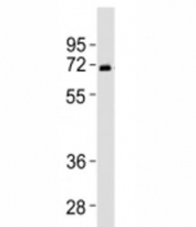 Western blot testing of SPHK2 antibody at 1:2000 dilution + human liver lysate. Predicted molecular weight ~69 kDa.