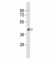 Western blot testing of BMI1 antibody at 1:2000 dilution + A549 lysate