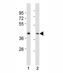 Western blot testing of BMI1 antibody at 1:2000 dilution. Lane 1: SW480 lysate; 2: HeLa lysate; Predicted molecular weight: 37-43 kDa.~