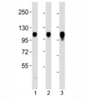 Western blot testing of Integrin alpha 7 antibody at 1:2000 dilution. Lane 1: HeLa lysate; 2: Jurkat lysate; 3: Raji lysate