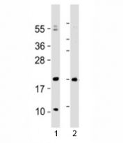 Western blot testing of Hopx antibody at 1:2000 with 1) human heart lysate and 2) mouse heart lysate