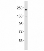 Western blot testing of RICTOR antibody at 1:2000 dilution + HepG2 lysate; Predicted molecular weight ~200 kDa.
